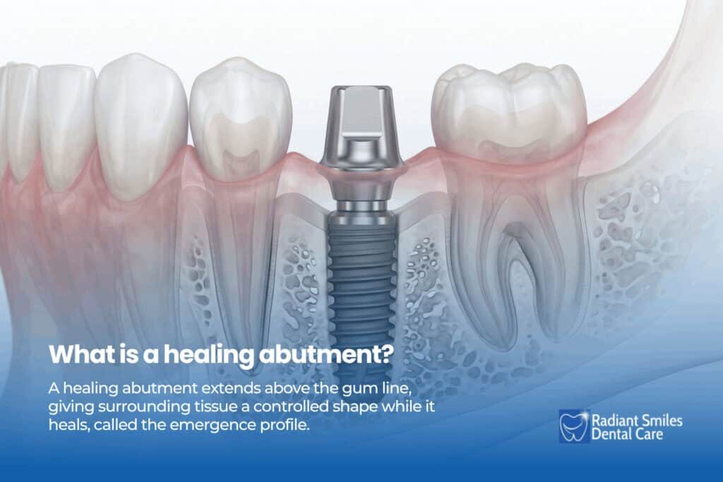 what is a healing abutment